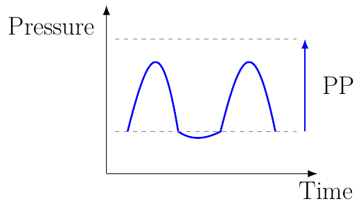 Pulse Pressure