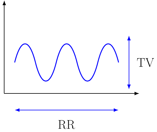 Ventilación Minuto