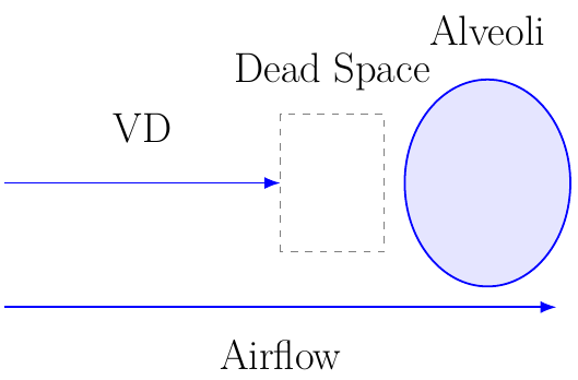 Ventilación del Espacio Muerto